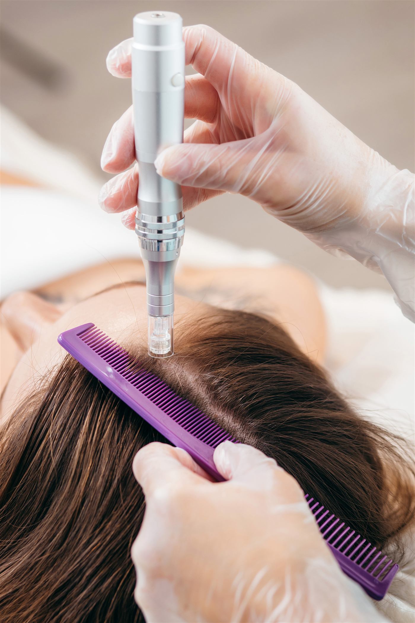 Aplicação de mesoterapia capilar com dermapen